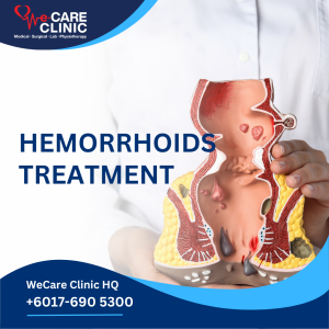 Hemorrhoids Treatment